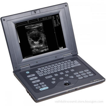 Laptop B/W Digital Ultrasound